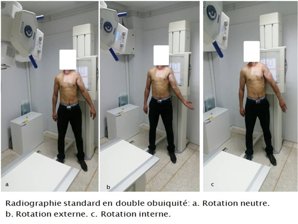 rotation interne et externe