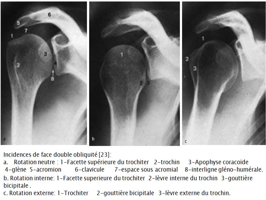 rotation interne et externe